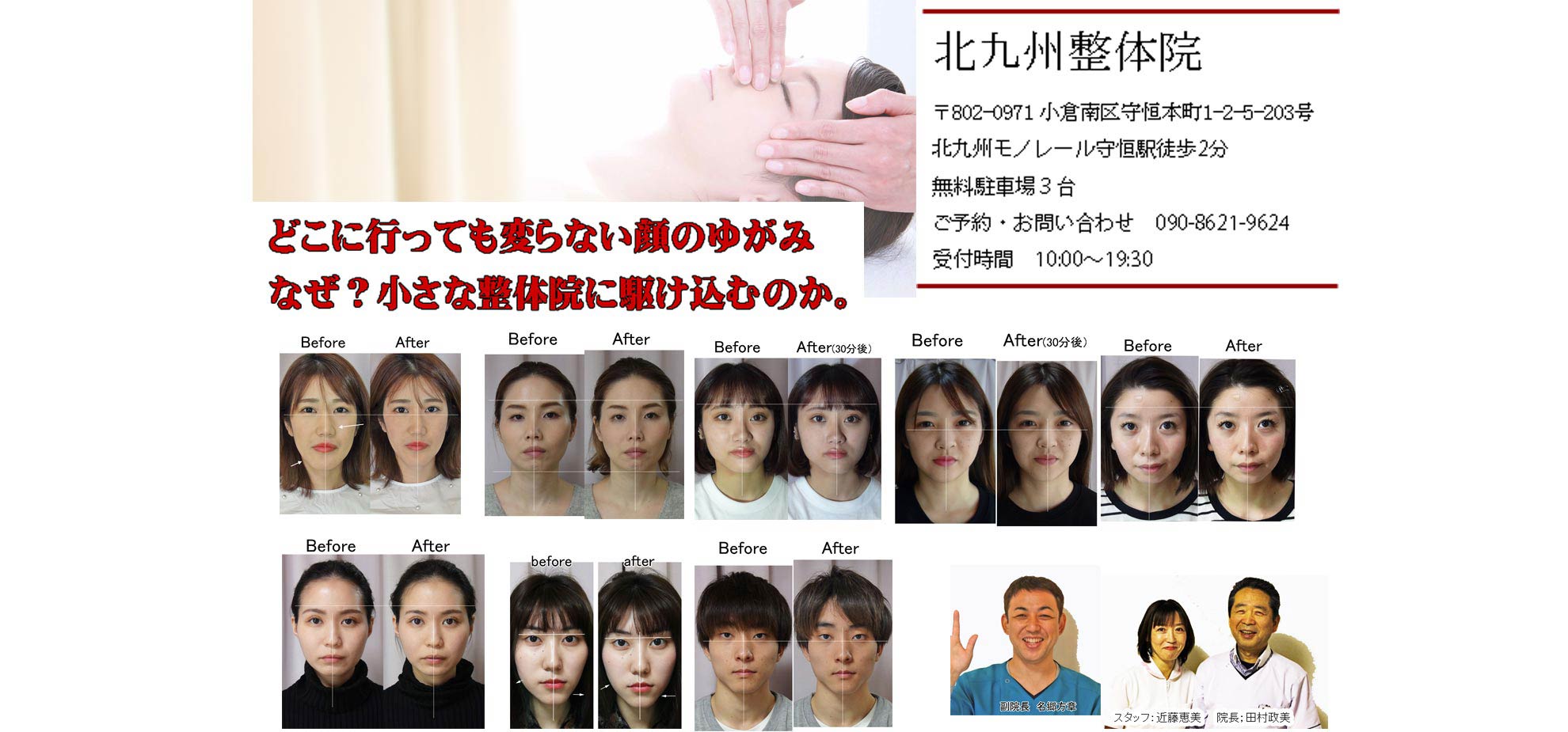 小倉南区北九州整体院の顔左右非対称/顔の歪み,顎の歪みを解決するページです